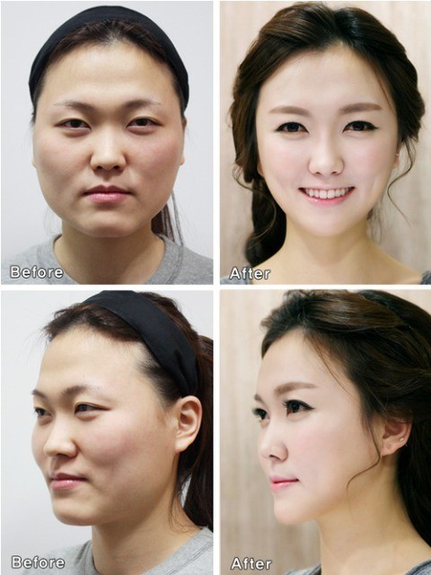 _plastic_surgery_09
